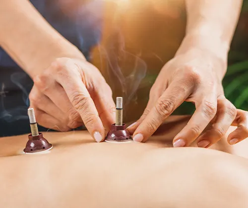 Moxibustion